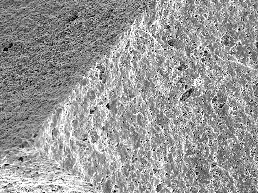 Ceramic Cast 8 Ceramic-Cast-2